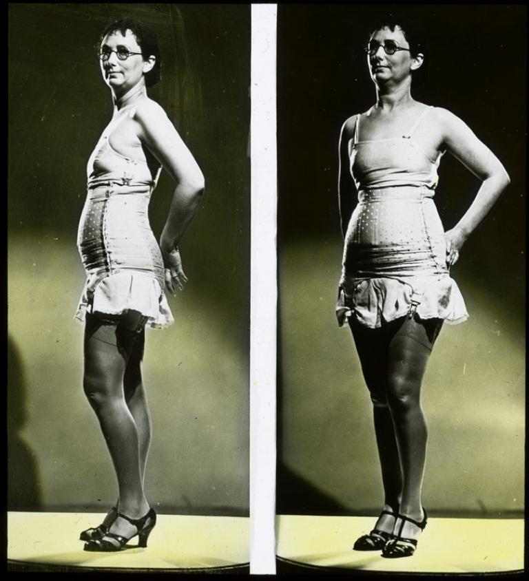 A side-by-side comparison of a woman wearing underwear, seen from two different angles. The slide is hand-coloured.