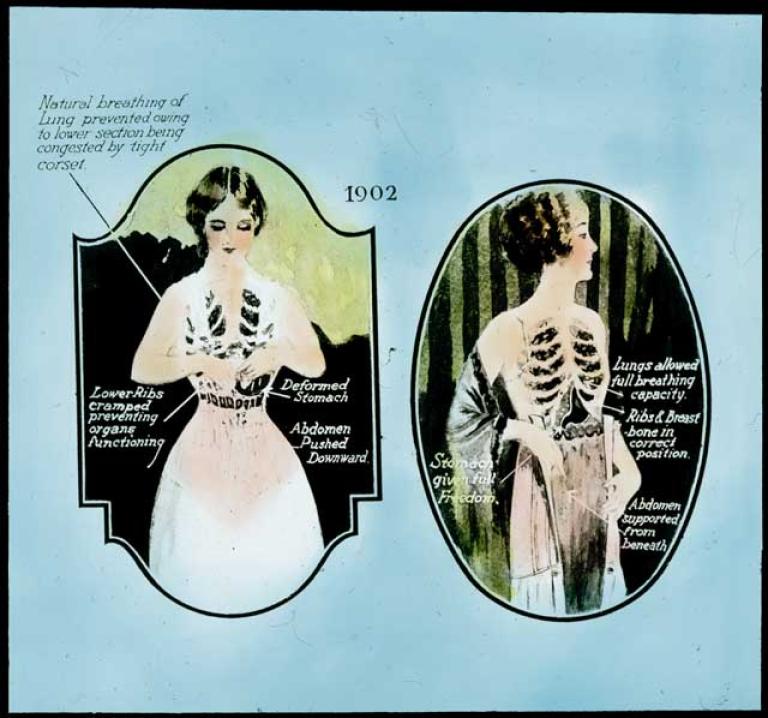 Slide shows diagrams of two women, one wearing a corset and one wearing Berlei foundation garment. The text talks about lung function.